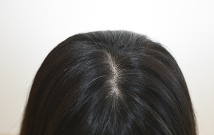 40代女性の髪の毛のイメージ